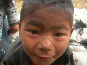 A boy in need.